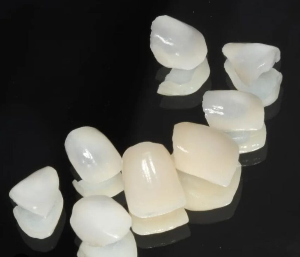 Material para restaurar os dentes: conheça a diferença entre eles