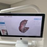 Odontologia digital: uma tecnologia que veio para ficar