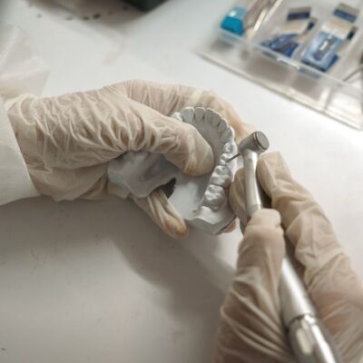 Restauração dental: cuidados para preservar seu tratamento