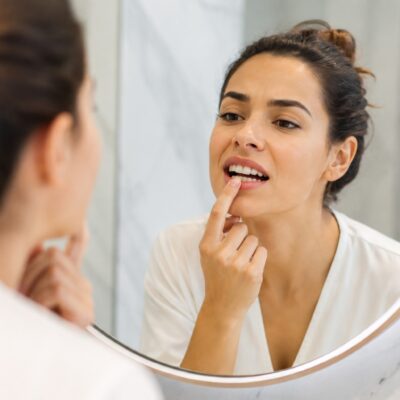 Pigmentação dentária: o que causa as manchas nos dentes e como tratá-las